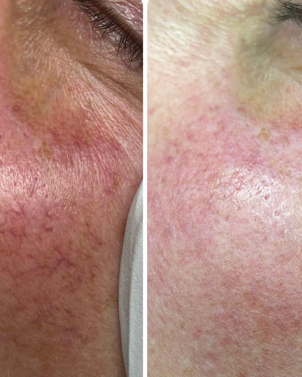 Sophie Esthétique Beauté - Épilation Laser Sherbrooke | 2873 Rue King E, Sherbrooke, QC J1G 5J1, Canada | Phone: (819) 238-9521