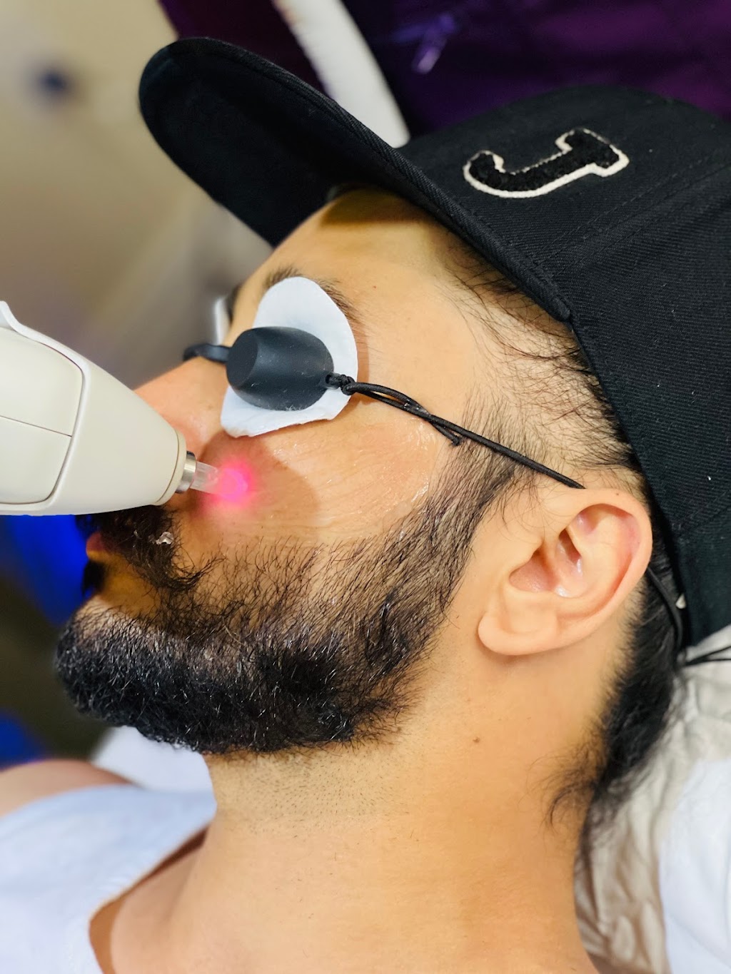Laser by Gigi | 21 Banks St, Brantford, ON N3T 0H7, Canada | Phone: (647) 539-4880