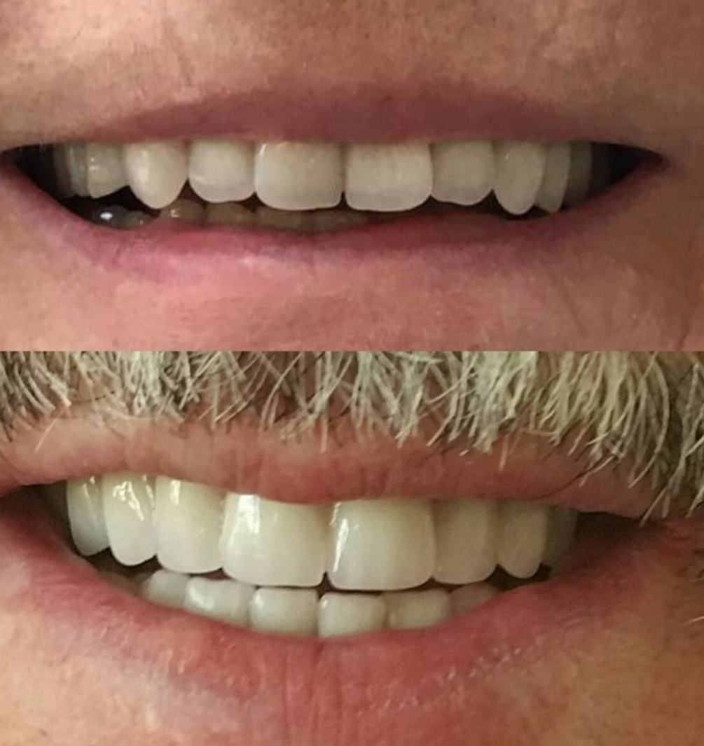 Denturologiste Rivière Rouge | 716 Rue LAnnonciation N Suite 202, Rivière-Rouge, QC J0T 1T0, Canada | Phone: (819) 275-2418