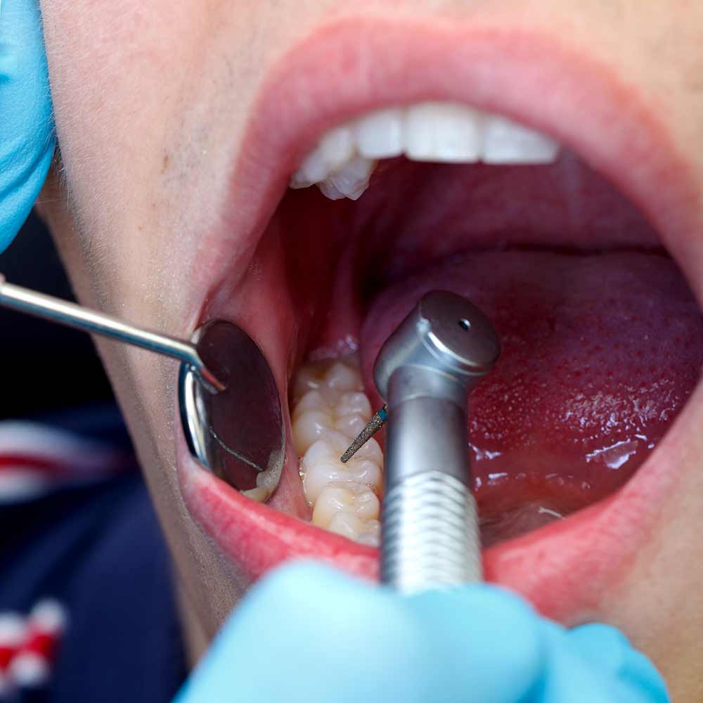 Emergency Dental Office | 7241 Bathurst St Unit 13, Thornhill, ON L4J 3W1, Canada | Phone: (905) 764-5399