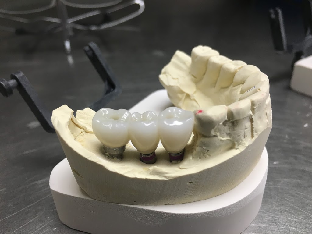 Proceram Dental Arts | 203-34654 Delair Rd, Abbotsford, BC V2S 2C9, Canada | Phone: (604) 853-7793