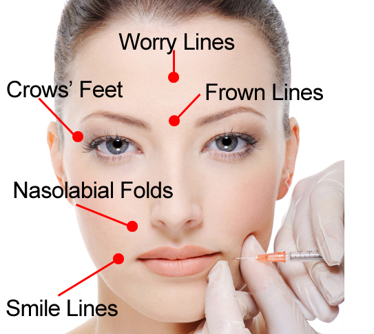 Adora Medical Esthetics Clinic | 6894 N Island Hwy # 9, Nanaimo, BC V9V 1P6, Canada | Phone: (250) 390-1160