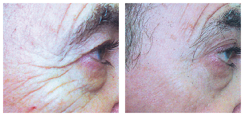 Skin Care Lazer YXE | Sunsera Salon. Ask for Olga (Laser technician, 815 Gray Ave, Saskatoon, SK S7N 2K6, Canada | Phone: (639) 318-9969