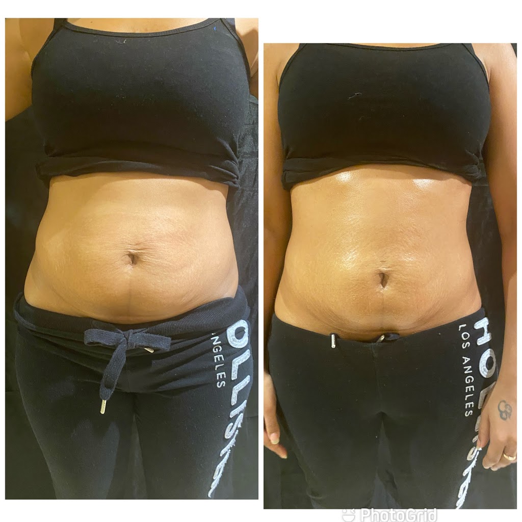 Body Perfection | 36 Tynevale Dr, Etobicoke, ON M9R 2B5, Canada | Phone: (647) 523-4526