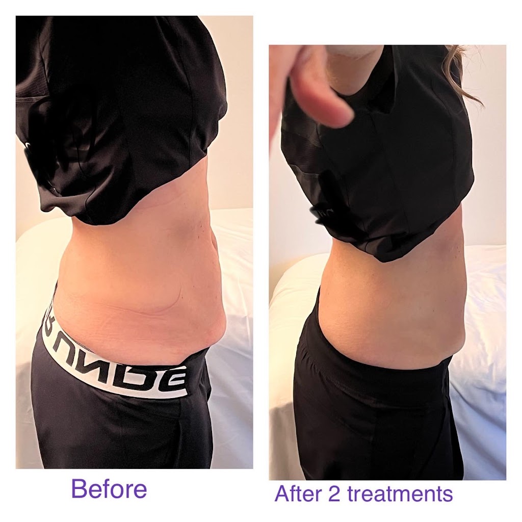 Flawlessly Sculpted Bodies by Patti | 132 St George St, St Thomas, ON N5P 2M1, Canada | Phone: (519) 719-6161