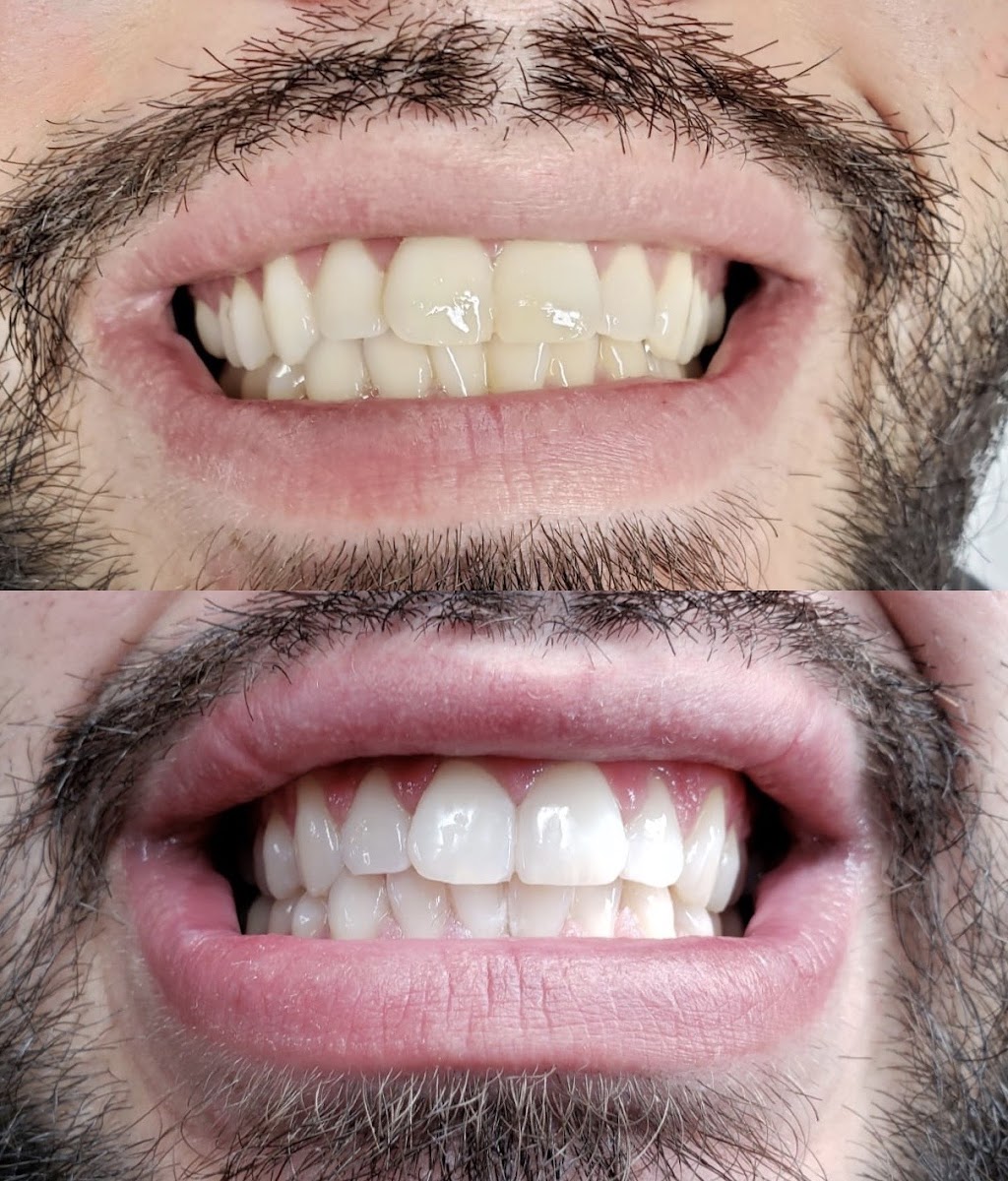 Reimagine Clinic | Montreal | 9359 Rue Lajeunesse, Montréal, QC H2M 1S5, Canada | Phone: (438) 686-8460