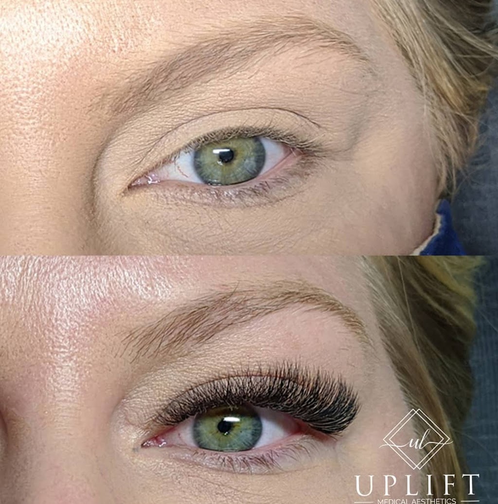 Uplift Medical Aesthetics | 2022 Main St N, Jarvis, ON N0A 1J0, Canada | Phone: (519) 420-9225