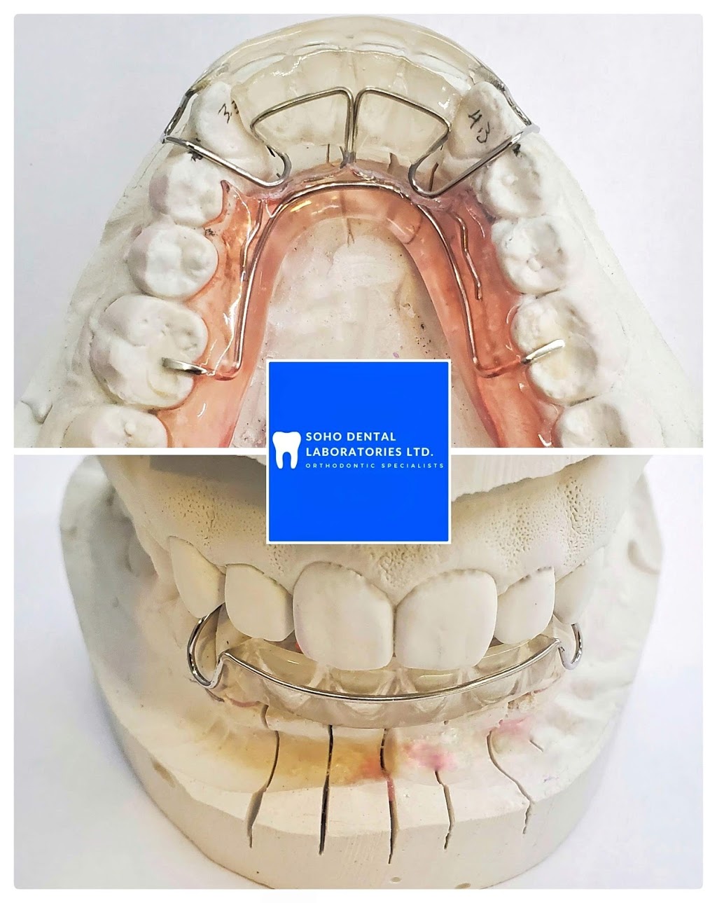 Soho Dental Laboratories Ltd | 4008 Deane Pl, North Vancouver, BC V7G 2P3, Canada | Phone: (604) 722-4855
