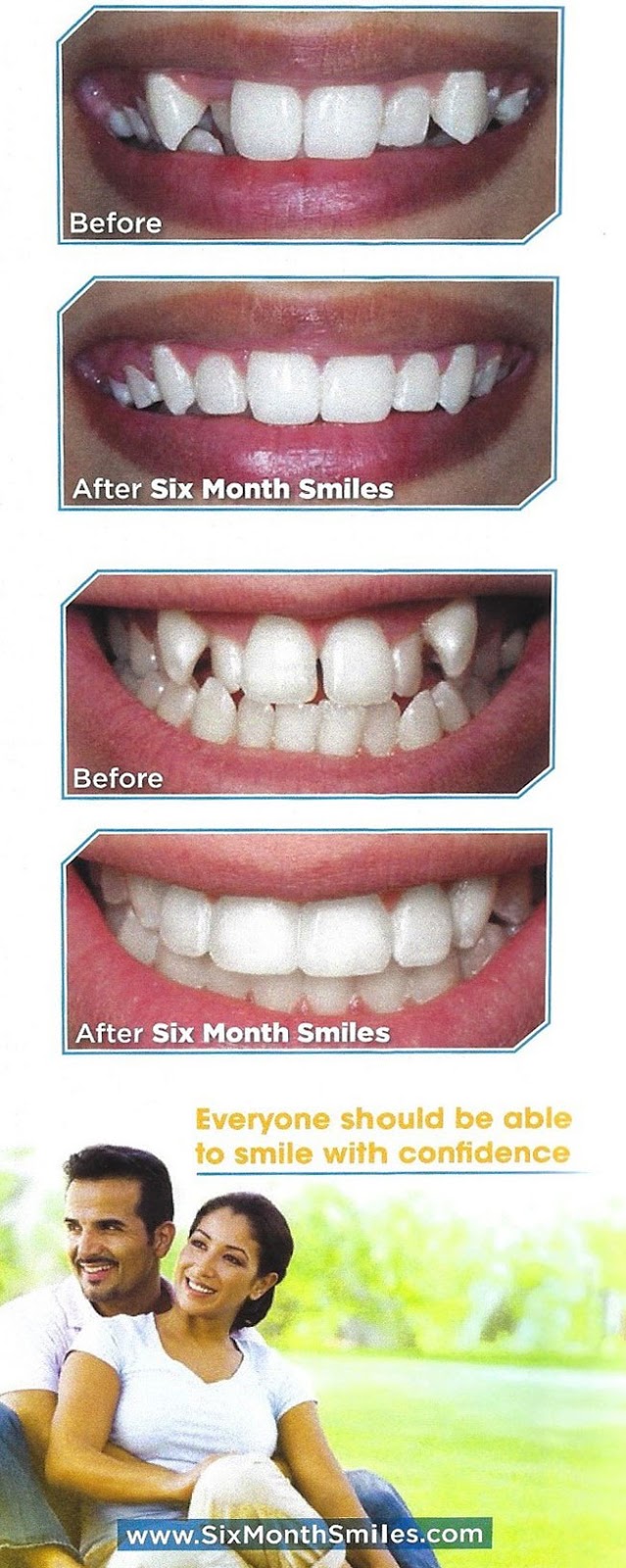 Centre Dentaire Lakeshore | 22 Rue Canvin, Kirkland, QC H9H 4S4, Canada | Phone: (514) 694-5716