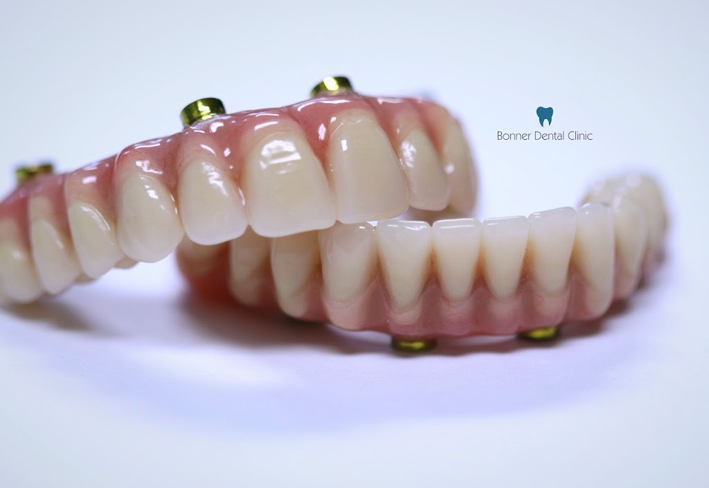Bonner Dental Clinic | 591 Rothesay Ave, Saint John, NB E2H 2G9, Canada | Phone: (506) 633-1086
