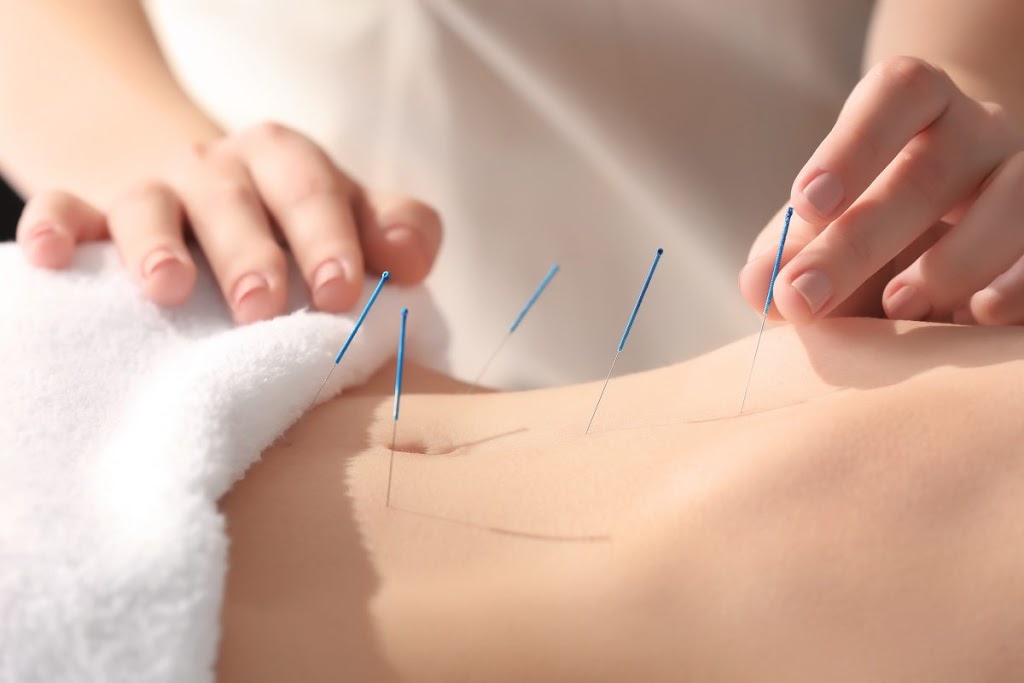 Emilie Lagarde Acupuncture | 253 Chemin de Lavaltrie bureau 102, Lavaltrie, QC J5T 2G8, Canada | Phone: (514) 627-0032