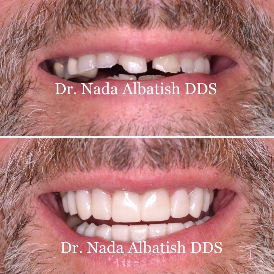 All Smiles Dental | 17725 Yonge St #104A, Newmarket, ON L3Y 7C1, Canada | Phone: (905) 235-6999