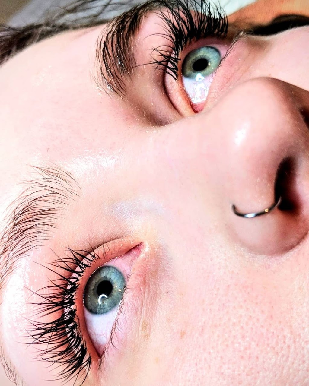 Emerald Esthetics | 62 Albert St N, Goderich, ON N7A 2N2, Canada | Phone: (519) 441-0650