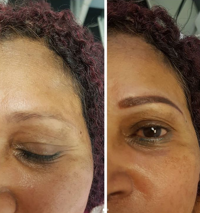 Medspa By Terezia | 200 Matheson Blvd W #104b, Mississauga, ON L5R 3L7, Canada | Phone: (416) 836-5500