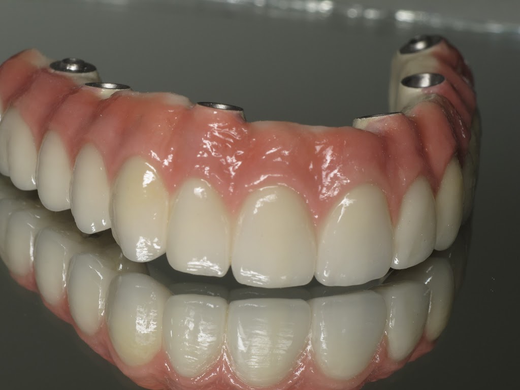 Inter Pro Dental Lab | 10578 109 St NW, Edmonton, AB T5H 3B2, Canada | Phone: (780) 429-2567