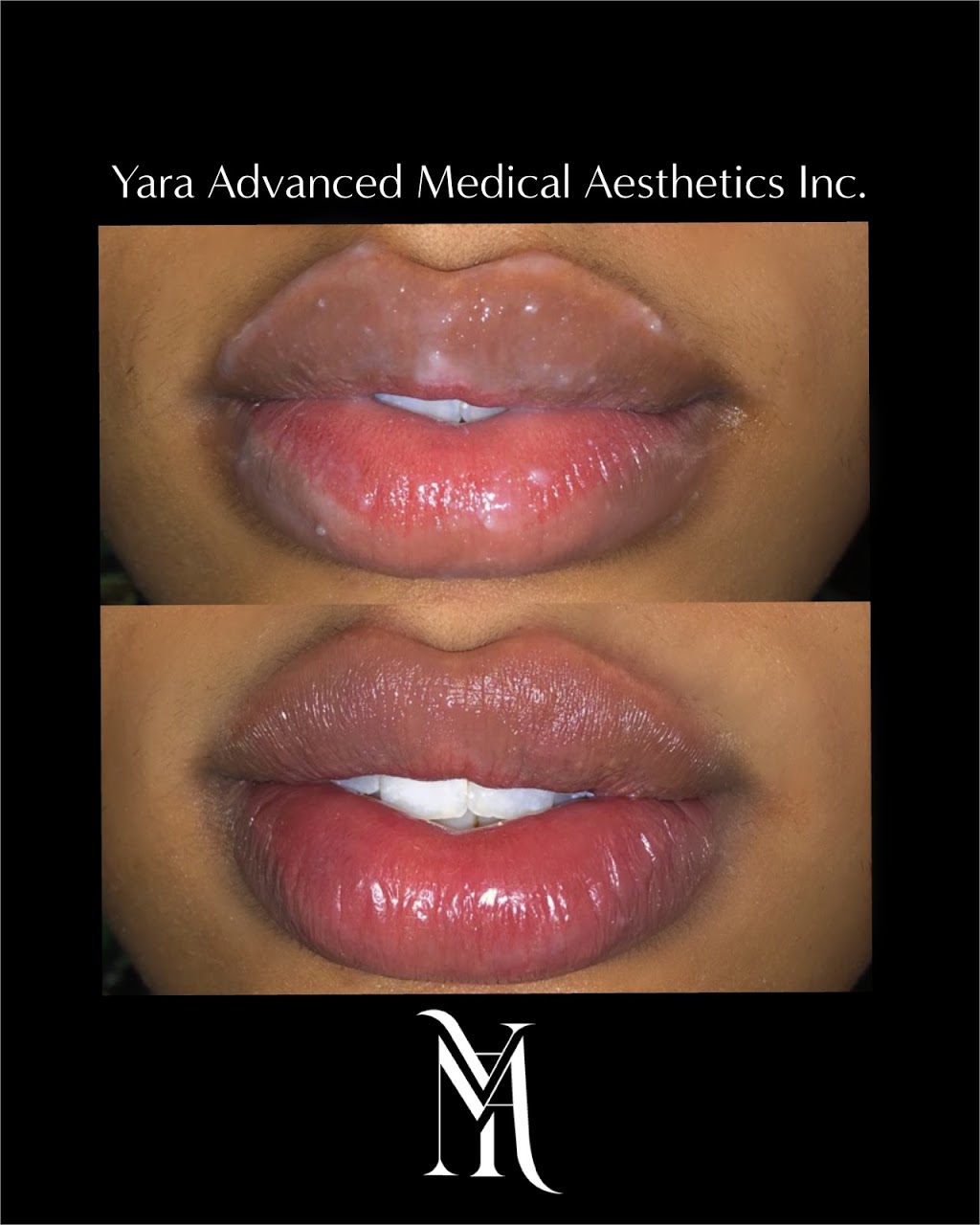 Nurse Yara | 69 Main Street east, Milton, ON L9T 8M5, Canada | Phone: (905) 462-6272