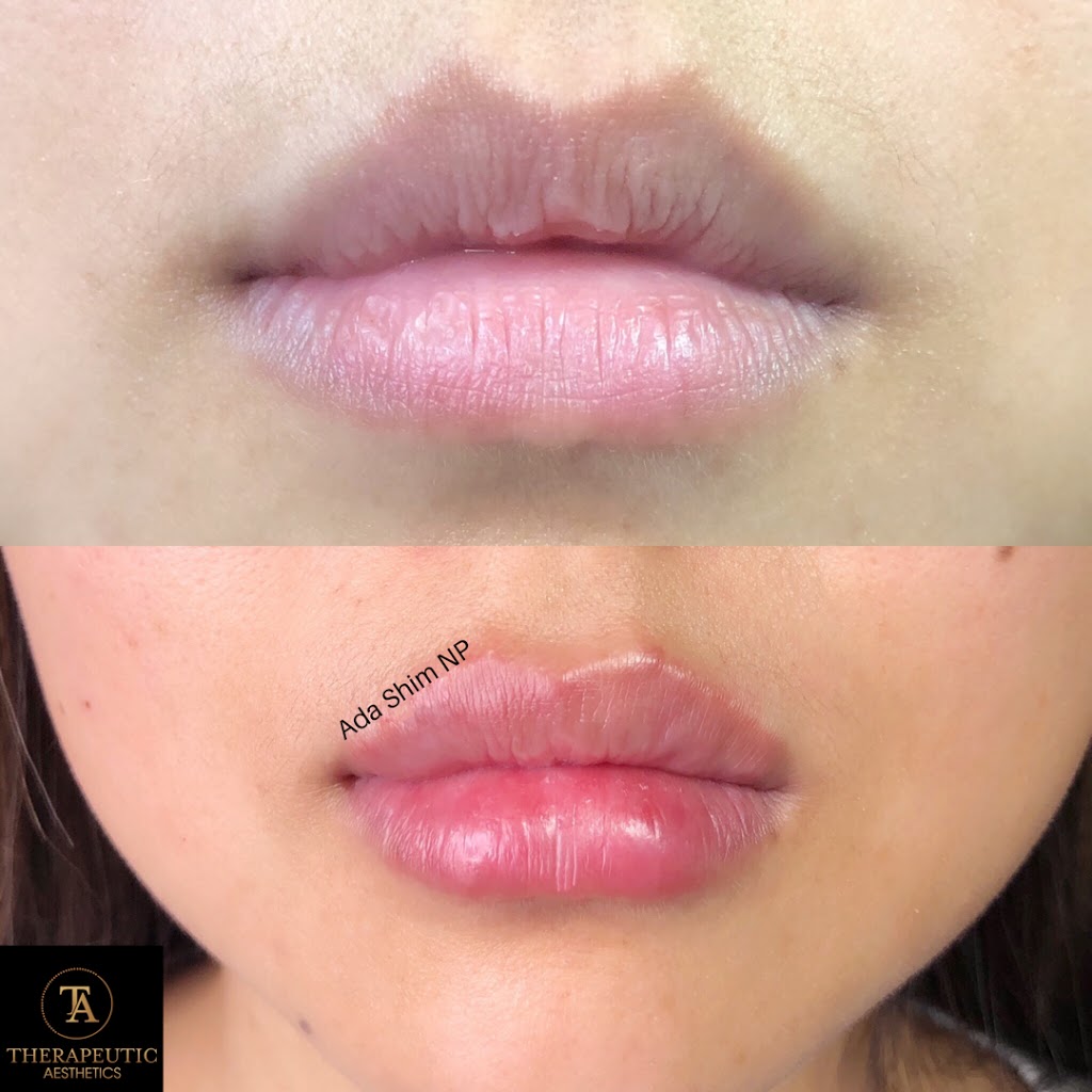 Therapeutic Aesthetics | 2108 Old Lakeshore Rd, Burlington, ON L7R 1A3, Canada | Phone: (416) 705-8672