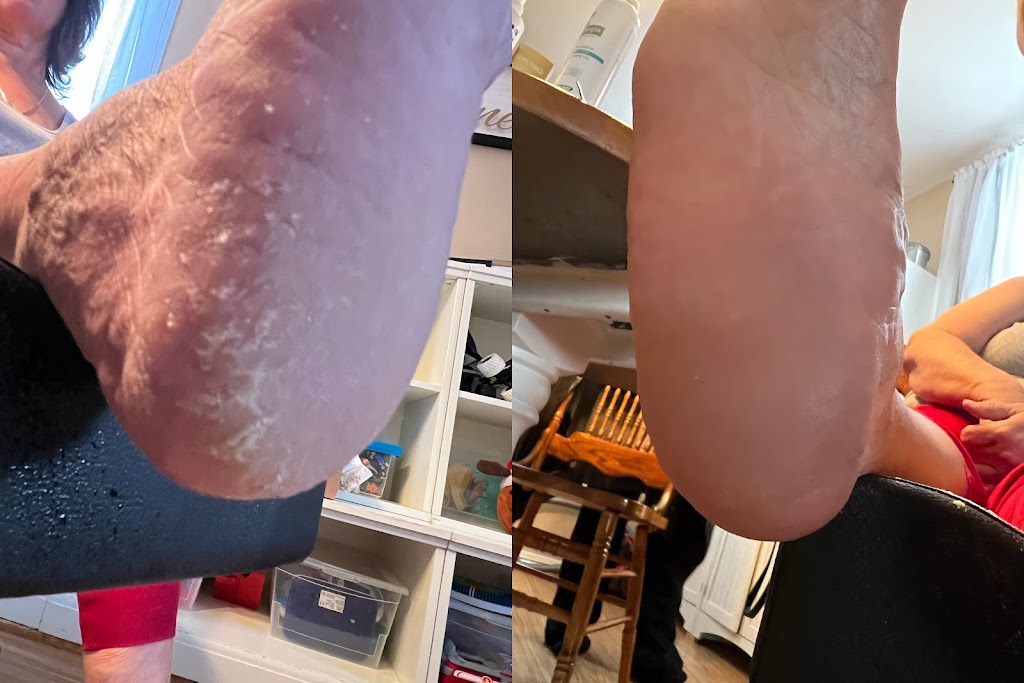 Highlands Foot Care | Young St, Maynooth, ON K0L 2S0, Canada | Phone: (519) 580-7121