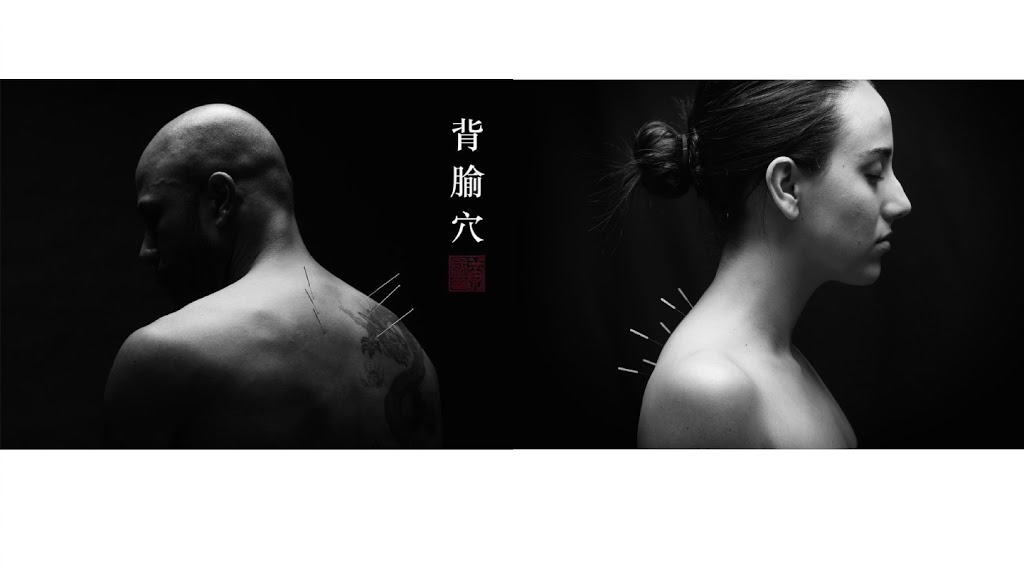 Inner Qi Acupuncture | 525 Snider Mountain Rd, Snider Mountain, NB E5P 4B4, Canada | Phone: (506) 434-0871