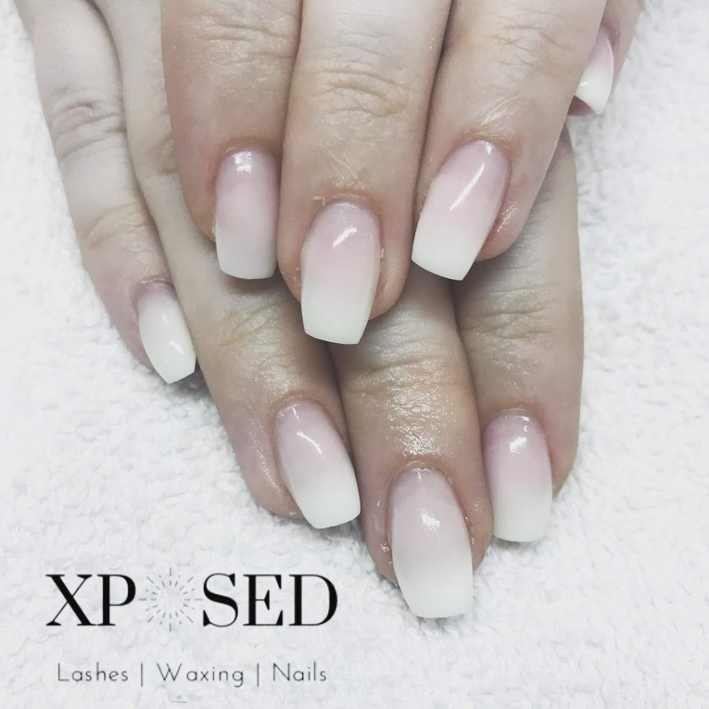 Xposed Esthetics | 529 Baycroft Dr, Martensville, SK S0K 2T2, Canada | Phone: (306) 203-4643