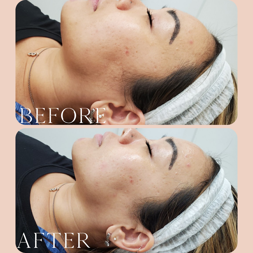 O Esthetics Kensington | 1217 Kensington Rd NW, Calgary, AB T2N 3P6, Canada | Phone: (403) 270-0723
