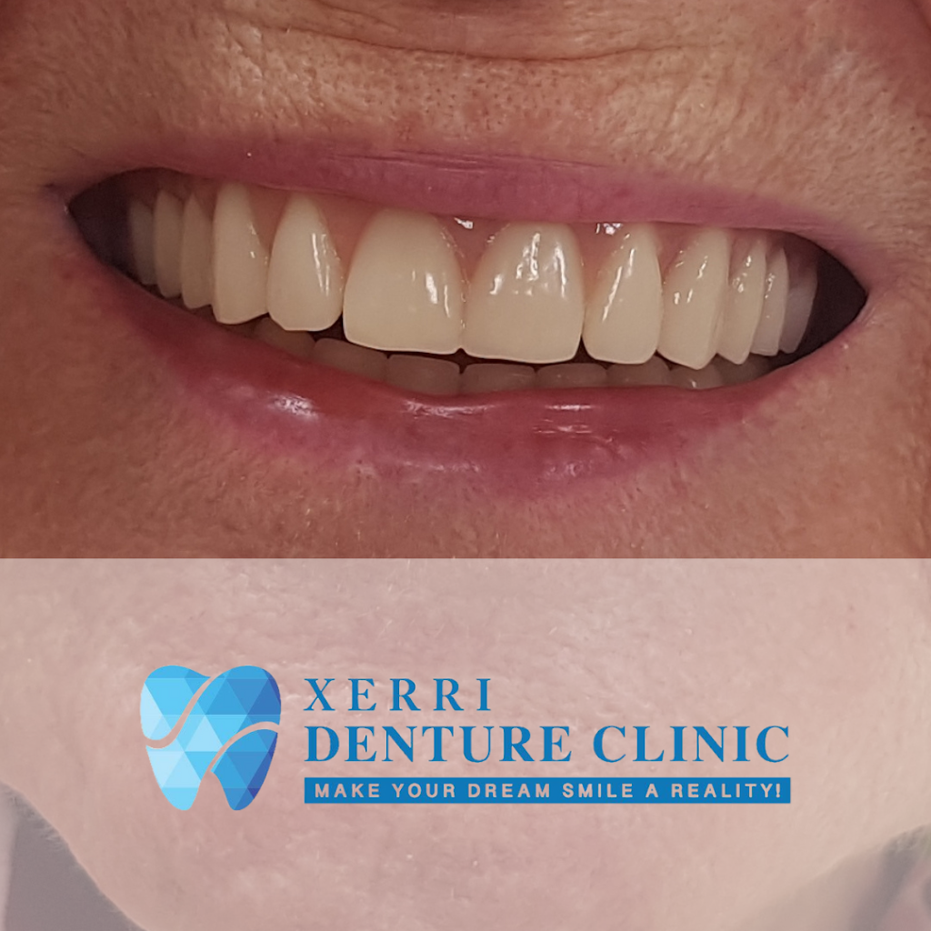 Xerri Denture Clinic | 6028 ON-89, Cookstown, ON L0L 1L0, Canada | Phone: (705) 435-6028