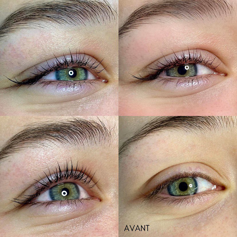 Esthétique by Alexe | Rue Thibault, Sherbrooke, QC J1H 5Z4, Canada | Phone: (581) 309-7068