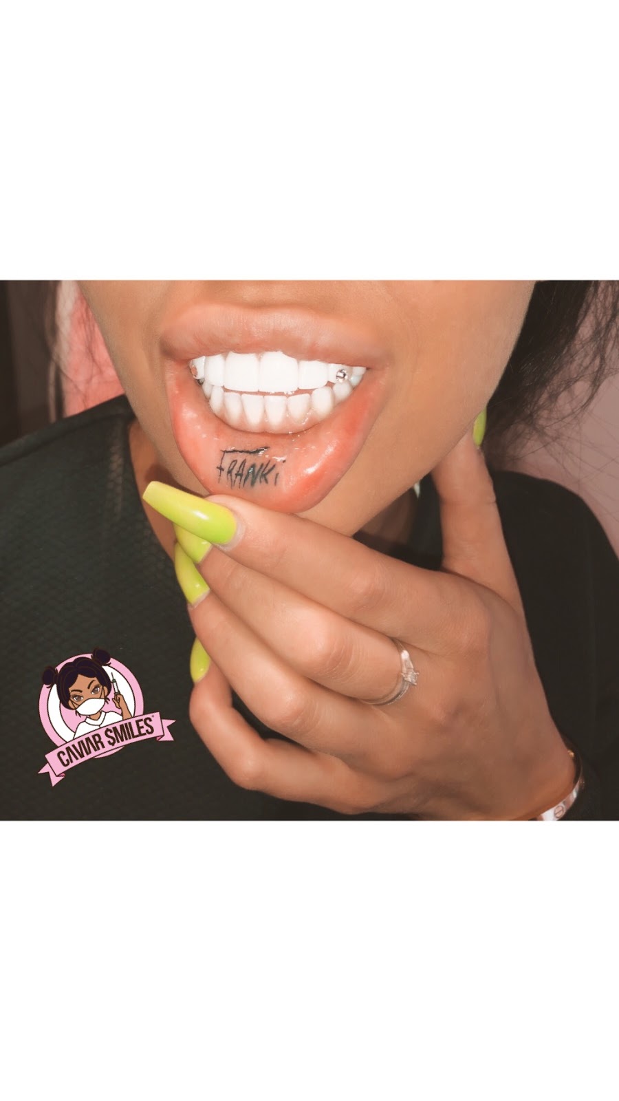 Caviar Smiles | 66 Walpole Ave #103, Toronto, ON M4L 3W5, Canada | Phone: (437) 220-9338