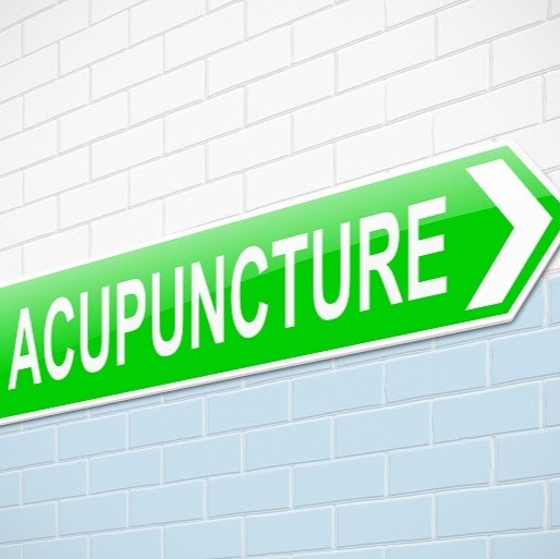 Holistic Acupuncture Clinic | 179 Main St N, Markham, ON L3P 1Y2, Canada | Phone: (905) 554-8849