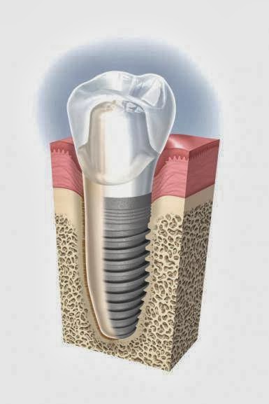Applewood Village Dentistry | 10-1077 N Service Rd, Mississauga, ON L4Y 1A6, Canada | Phone: (905) 279-1818