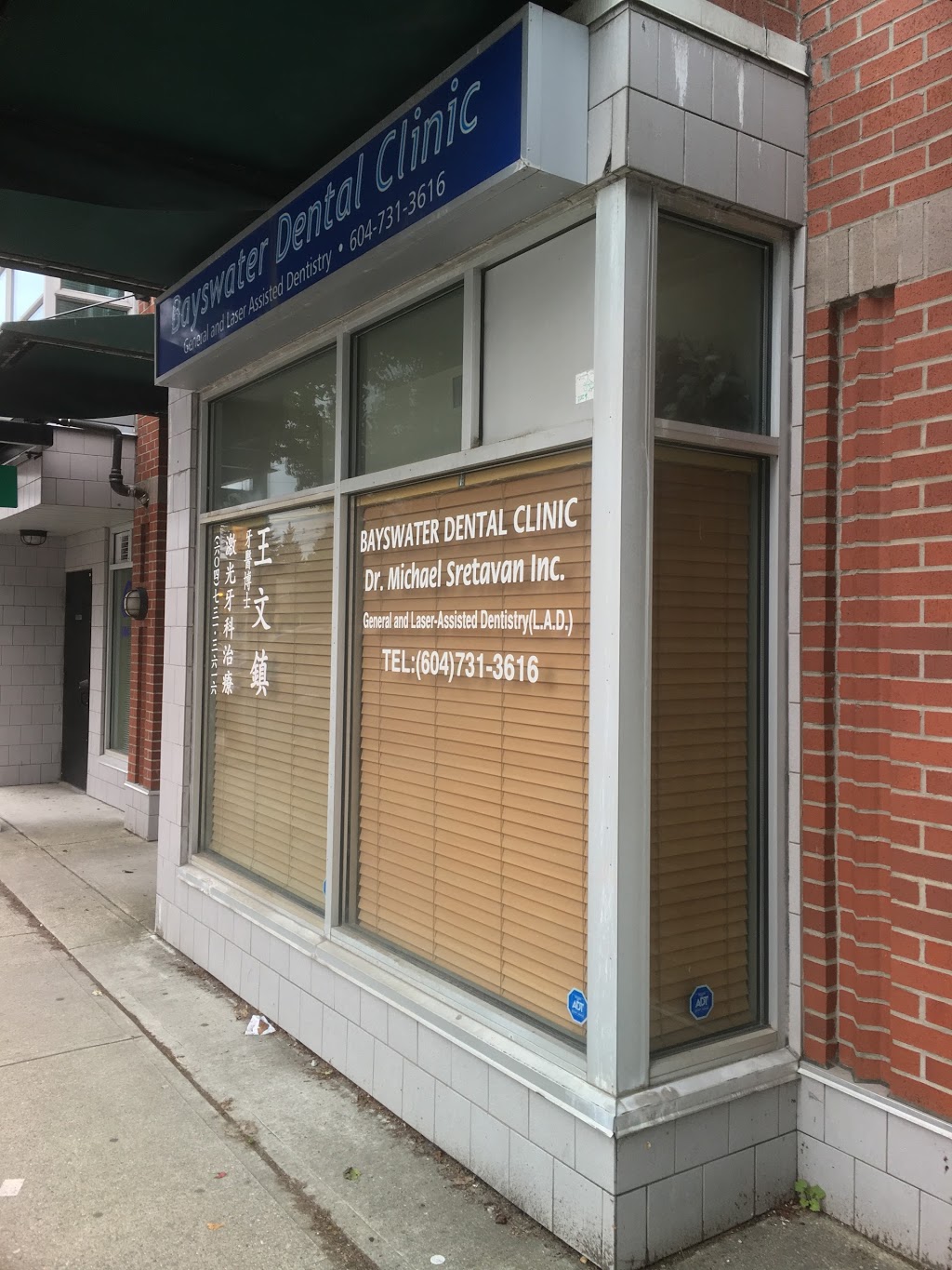 Bayswater Dental Clinic | 2943 W 4th Ave, Vancouver, BC V6K 1R3, Canada | Phone: (604) 731-3616