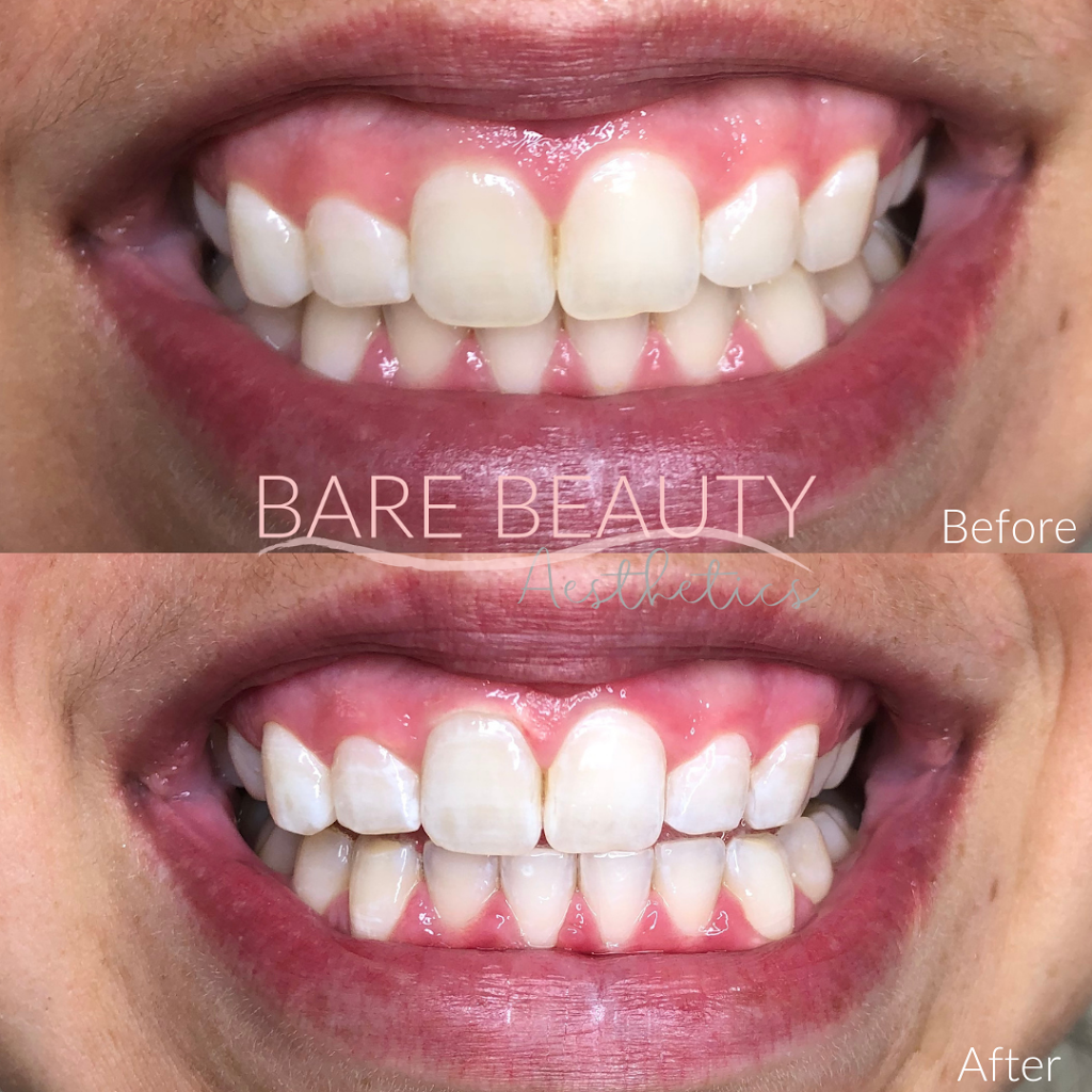 Bare Beauty Aesthetics | 976 Shadeland Ave #3, Burlington, ON L7T 2M5, Canada | Phone: (289) 208-3634