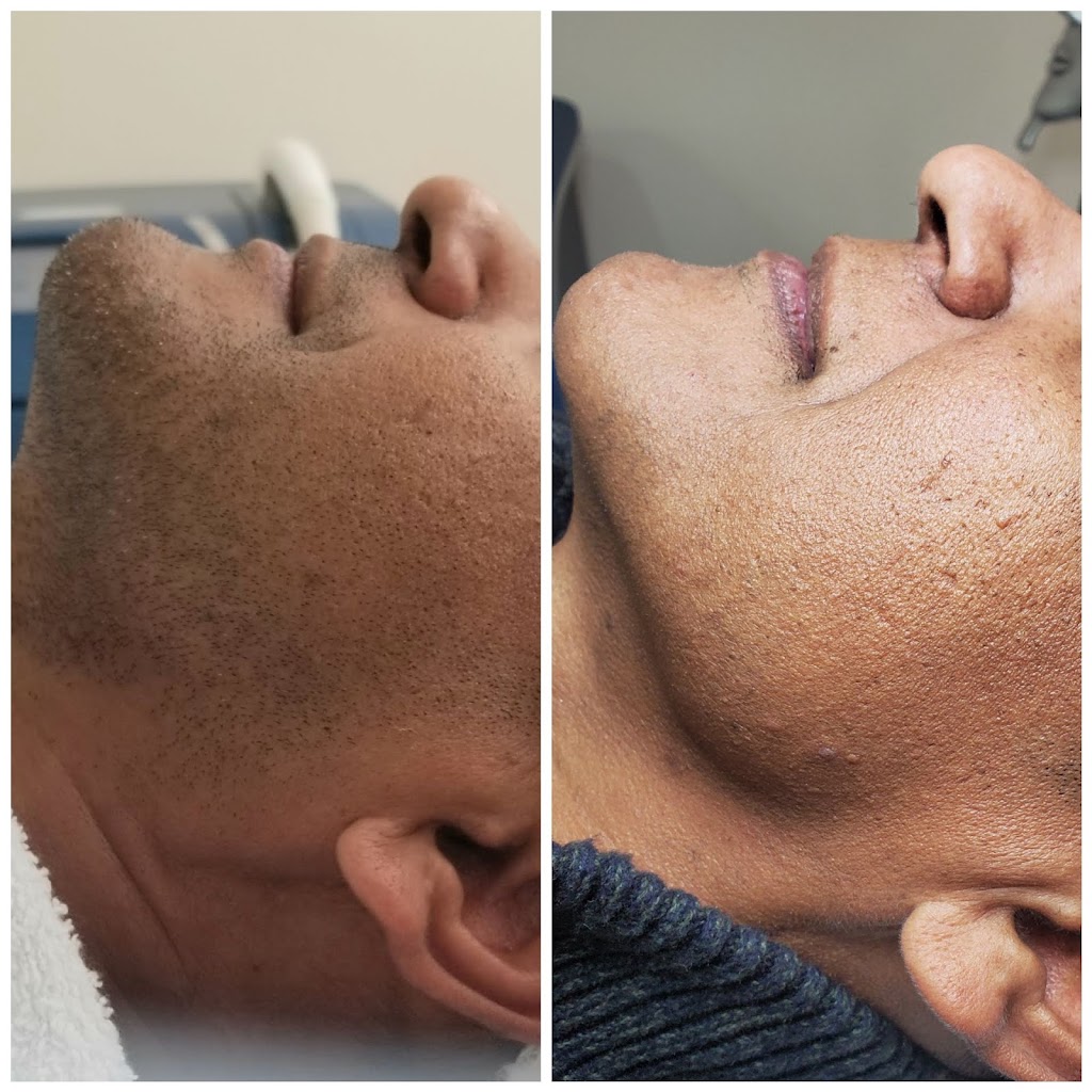 Skin Essentials Laser Clinic | 58 Cathedral High St, Markham, ON L6C 0P3, Canada | Phone: (416) 843-7458