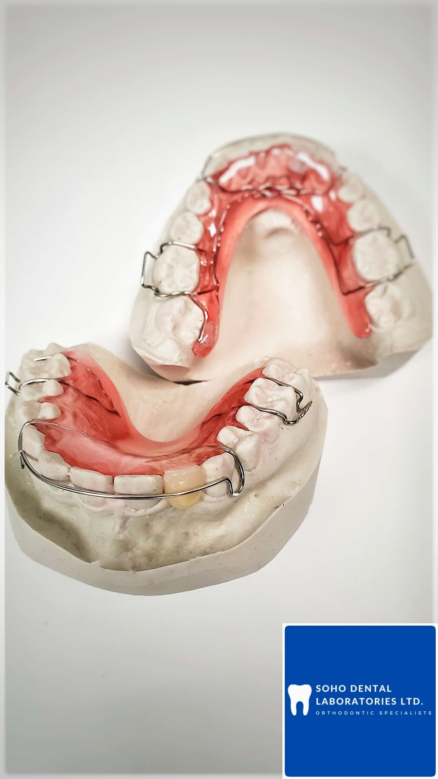 Soho Dental Laboratories Ltd | 4008 Deane Pl, North Vancouver, BC V7G 2P3, Canada | Phone: (604) 722-4855