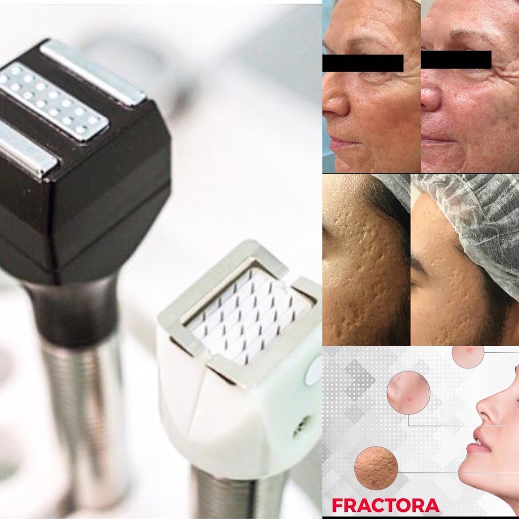 Tina Elio Anti-Aging & Laser Clinic | 51A Underhill Dr Suite #205, North York, ON M3A 1J2, Canada | Phone: (416) 523-3756
