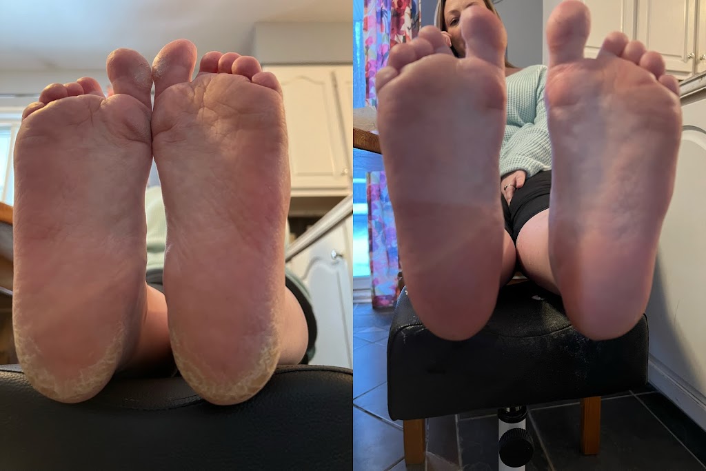 Highlands Foot Care | Young St, Maynooth, ON K0L 2S0, Canada | Phone: (519) 580-7121