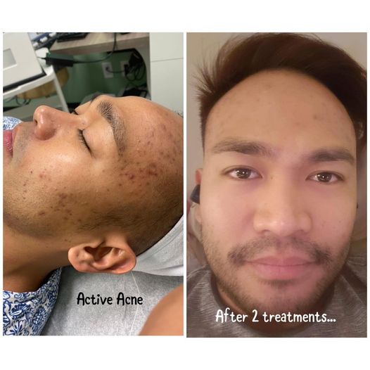 Cylohni Beauty Medical Aesthetics | 7101 50 Ave #100, Red Deer, AB T4N 4E4, Canada | Phone: (403) 588-7796