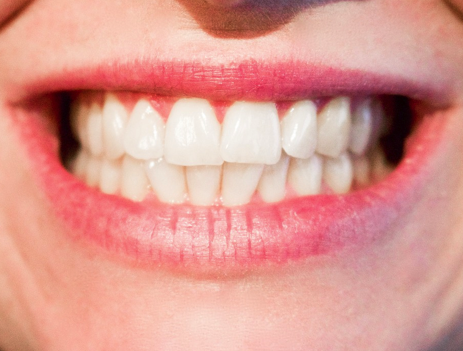 Aline Delfosse et Associés Denturologiste | 3125 Montée Saint-Hubert, Saint-Hubert, QC J3Y 4J2, Canada | Phone: (450) 676-3279