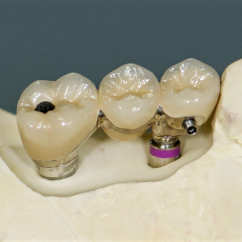DEN-TECH London Laboratory | 1373 Westdel Bourne, London, ON N6K 4R1, Canada | Phone: (519) 657-7109
