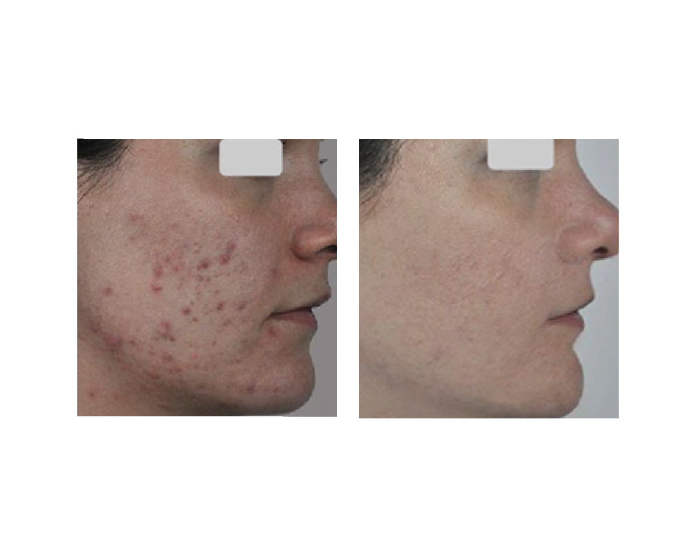 Laser And Lash Clinic | 633 King St E unit# 206, Oshawa, ON L1H 1G3, Canada | Phone: (416) 896-5274