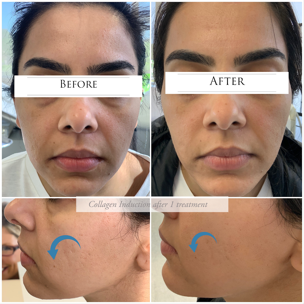 Dermace Advanced Skin Care Clinic | 6633 Hwy 7 suite 303, Markham, ON L3P 7P2, Canada | Phone: (905) 554-8144