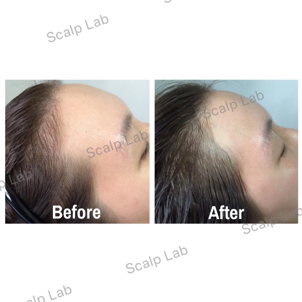 Scalp Lab | 135 Village Green Square, Scarborough, ON M1S 0G4, Canada | Phone: (416) 823-9300