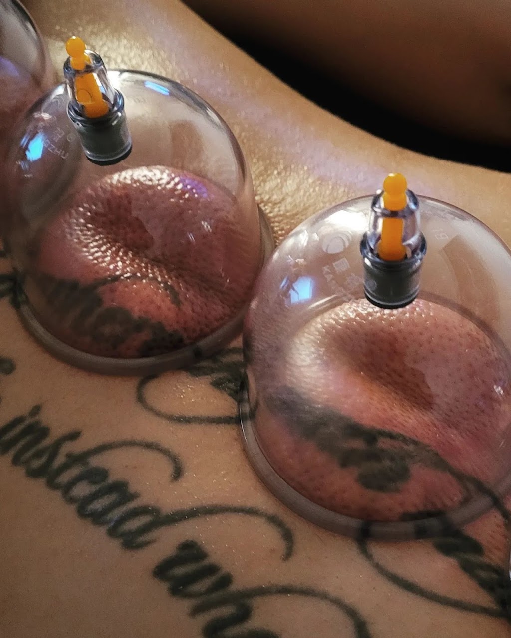 Clinique de massothérapie Reset | 911 R. Vinet, Salaberry-de-Valleyfield, QC J6S 0C9, Canada | Phone: (450) 288-3719