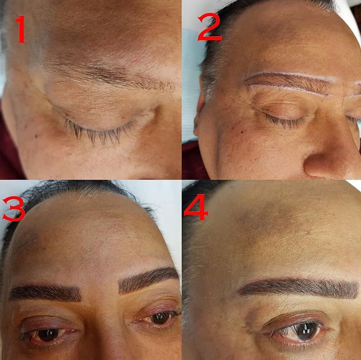 Medspa By Terezia | 200 Matheson Blvd W #104b, Mississauga, ON L5R 3L7, Canada | Phone: (416) 836-5500