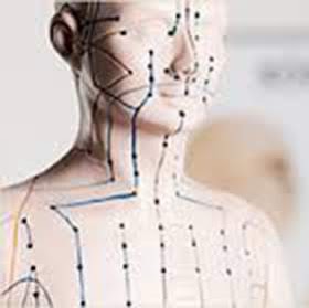 Caroline Lussier Acupuncteure | 6165 Boulevard Laframboise #101, Saint-Hyacinthe, QC J2R 1G2, Canada | Phone: (450) 796-1212