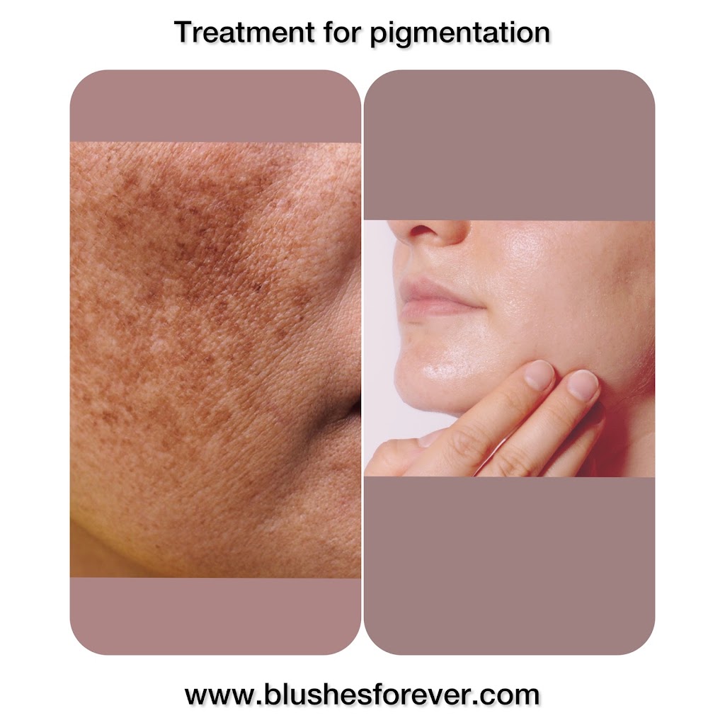 Blushes Forever Skin Care | H11C, 260300 Writing Creek Cres, Balzac, AB T4A 0X8, Canada | Phone: (825) 365-1610