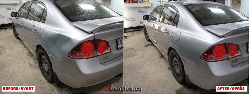 Dent Tec | 93 Rue Robert-Pilon, Gatineau, QC J9J 2X8, Canada | Phone: (819) 743-5252