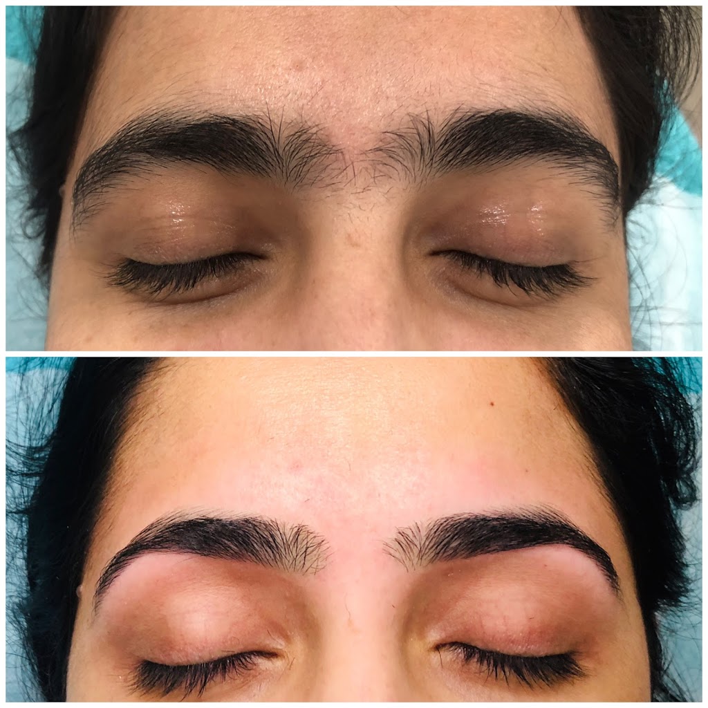 Moon Aesthetics n Solutions | 159 Shephard Ave, Alliston, ON L9R 0J8, Canada | Phone: (705) 718-1836