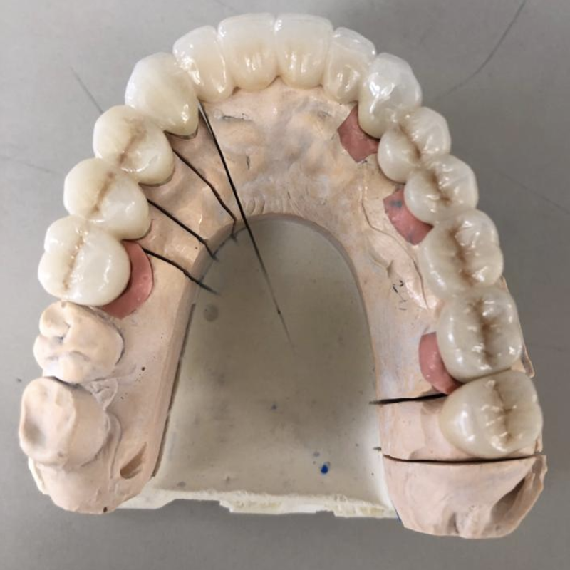 Innovative Dental Laboratories | 1706 Danforth Ave, Toronto, ON M4C 1H8, Canada | Phone: (416) 463-3138