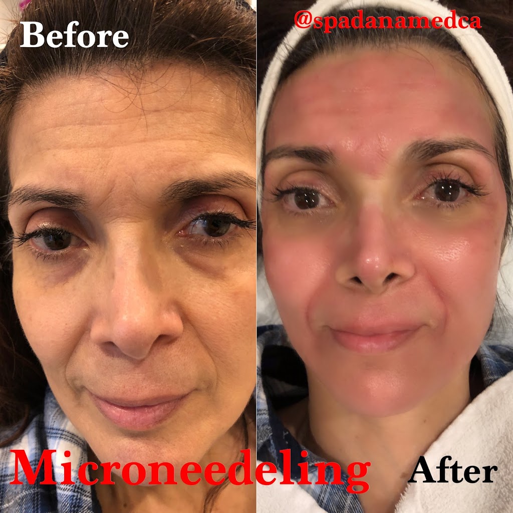 Spadana Spa & Laser Clinic | 44 Levendale Rd, Richmond Hill, ON L4C 4H2, Canada | Phone: (416) 877-0560